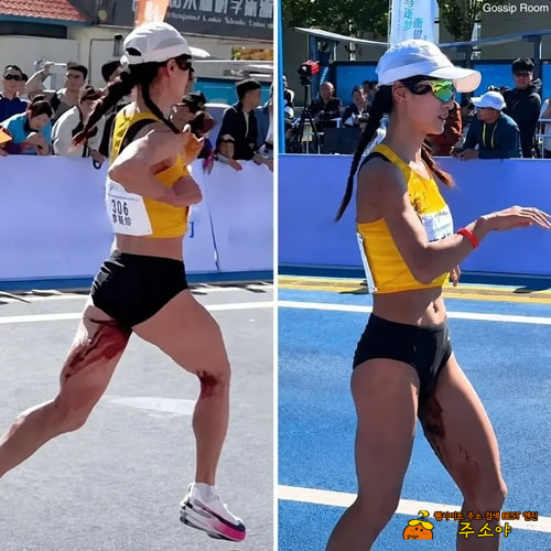 도핑떄문에 함부로 약도 못먹고 대단 도핑떄문에 함부로 약도 못먹고 대단