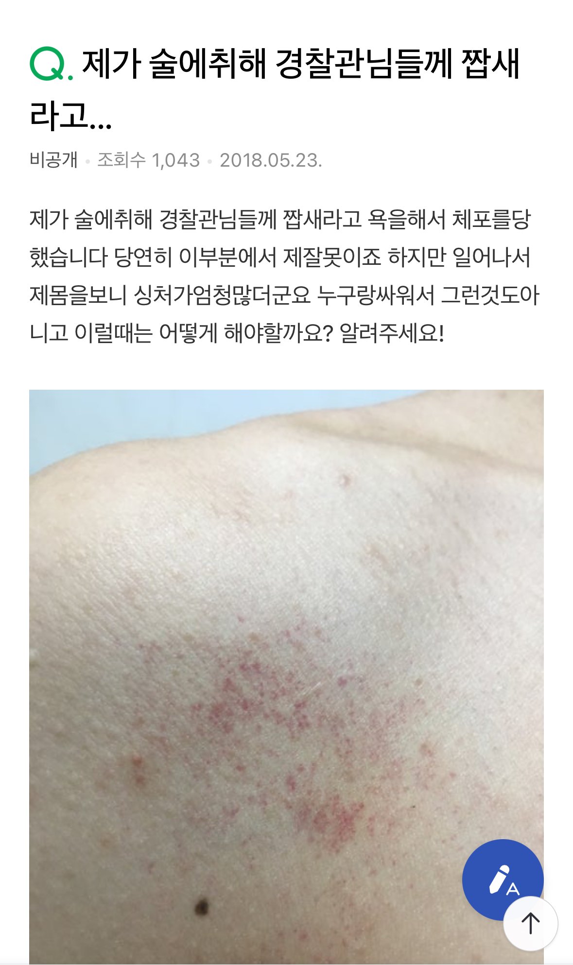 한국 경찰한테 짭새라하는 취객 과잉진압?