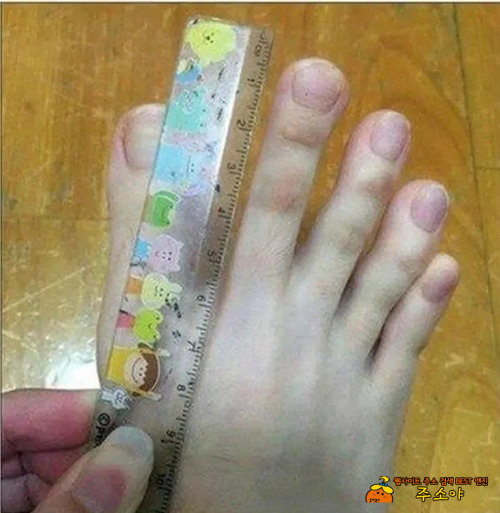 발가락 사이즈가
